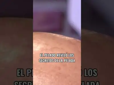 “LA PELADA ESTÁ INFRAVALORADA”